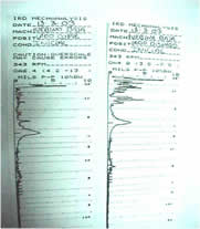 reporte